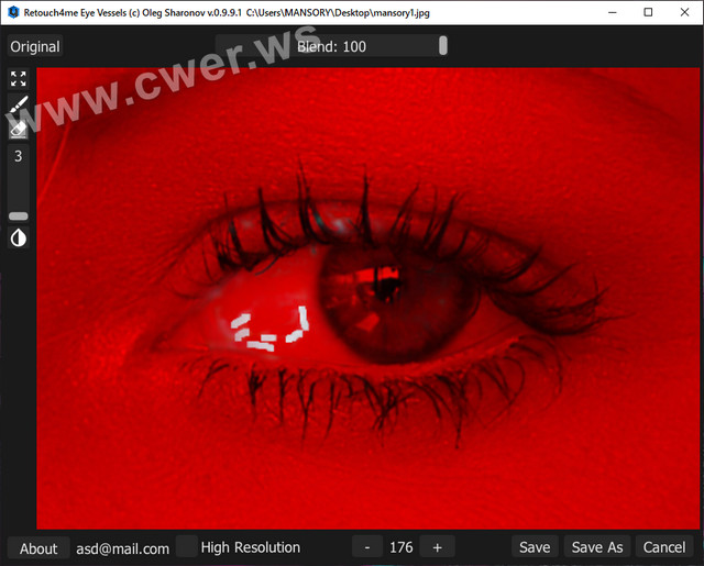 Retouch4me Eye Vessels 0.9.9.1